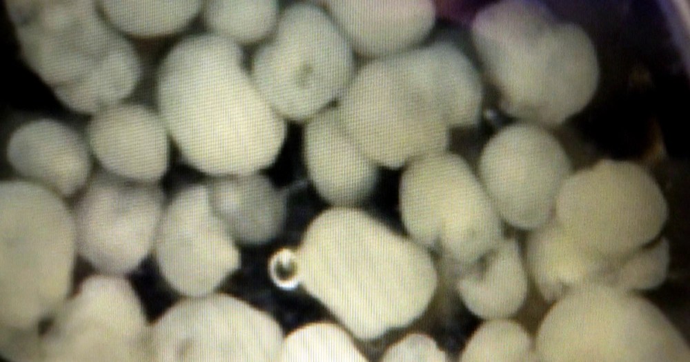 Minicérebros cultivados em laboratório. Estruturas estão ajudando a compreender os efeitos da infecção por zika.