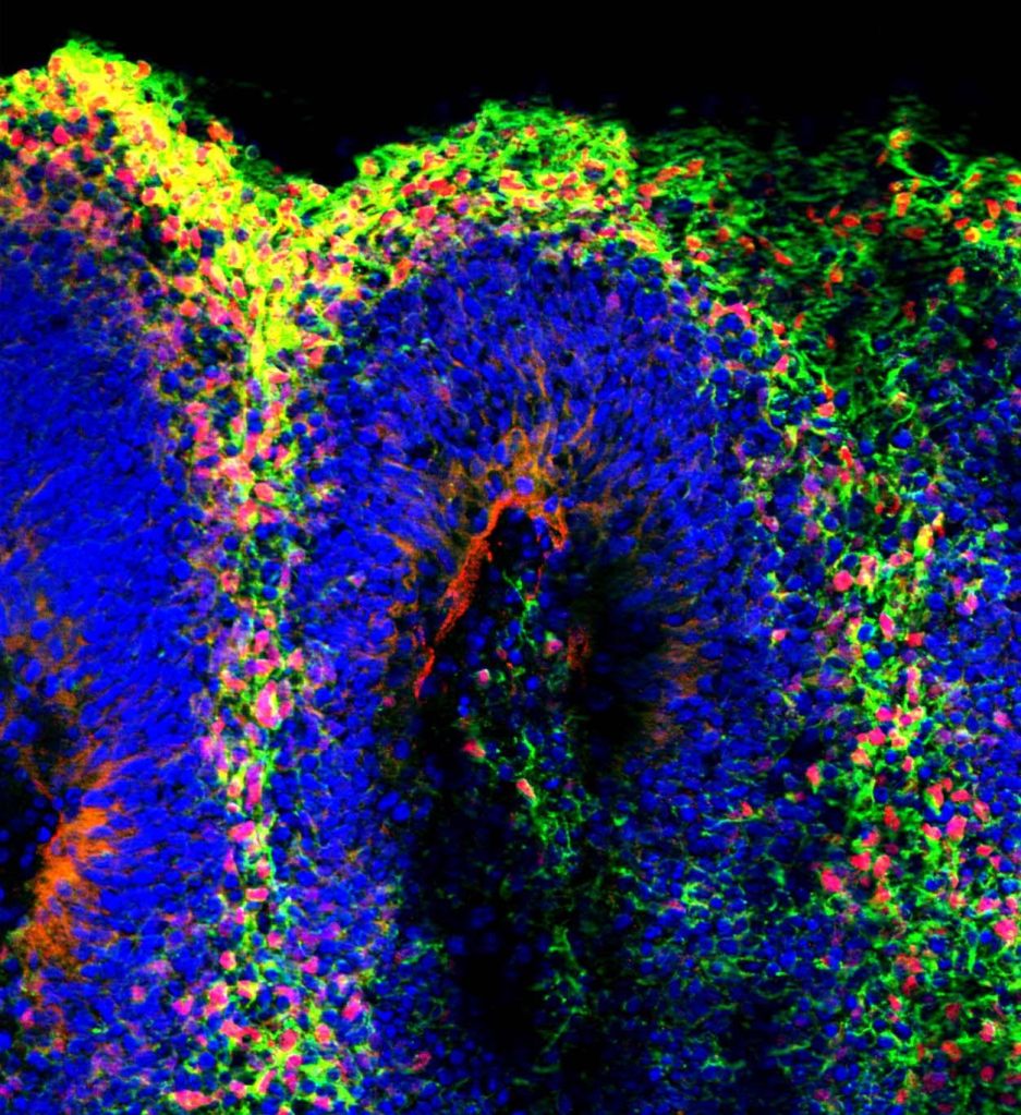 Mini cérebro criado pela equipe de Alysson Muotri.